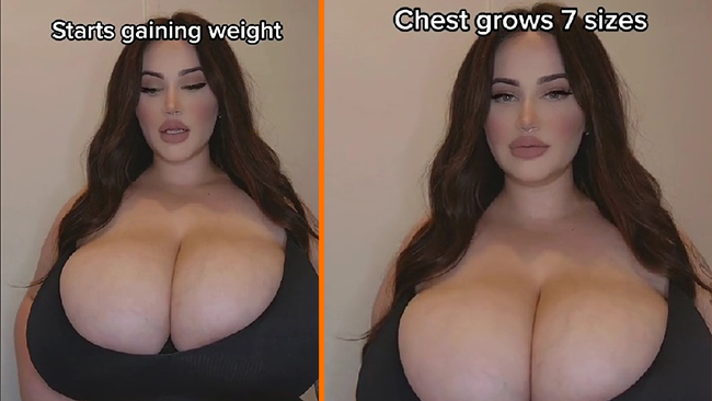 Modellens bröst slutade inte växa
